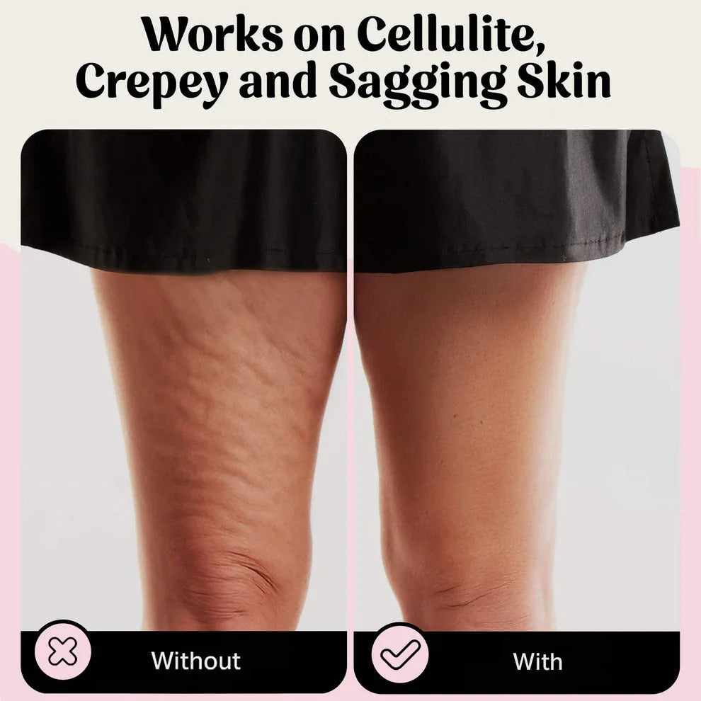 VellaShape™ Body Tape — Adhesive Body-Contouring Strips