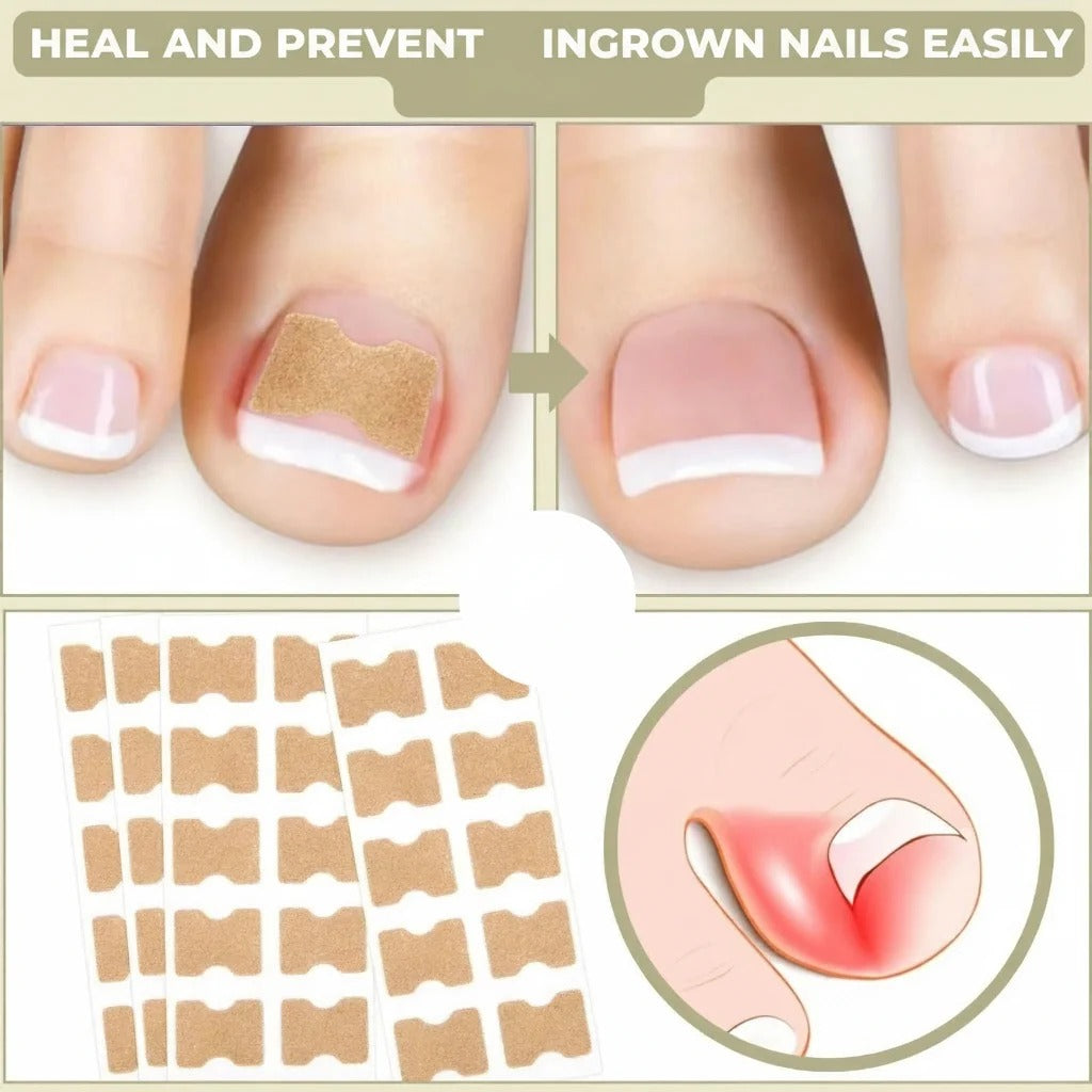 Toenail Correction Patches