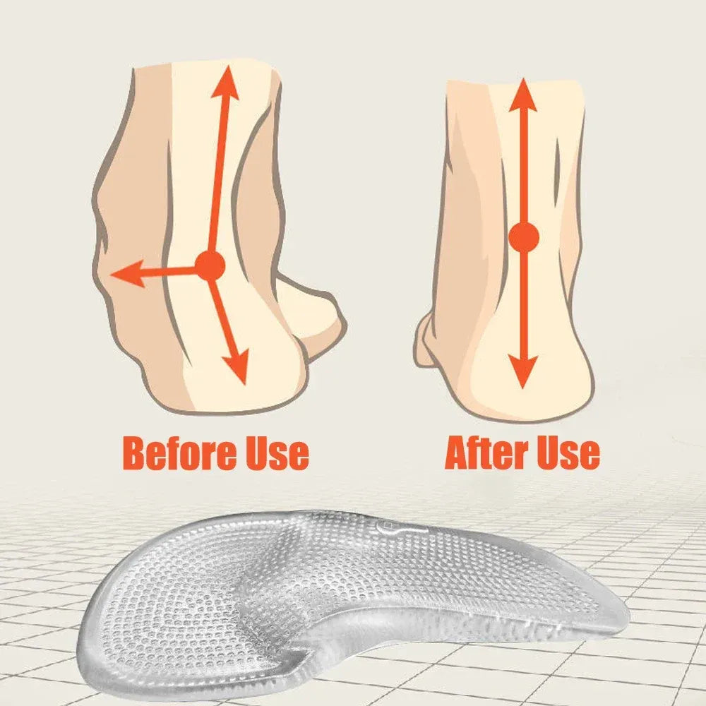 Silicone Gel Insoles